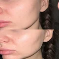 Отзыв на тоник для лица Гельтек hyaluronic acid and elastin